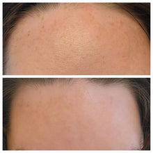 Load image into Gallery viewer, best hydrating serum. Before and after comparison using Brody Brielle hydration serum
